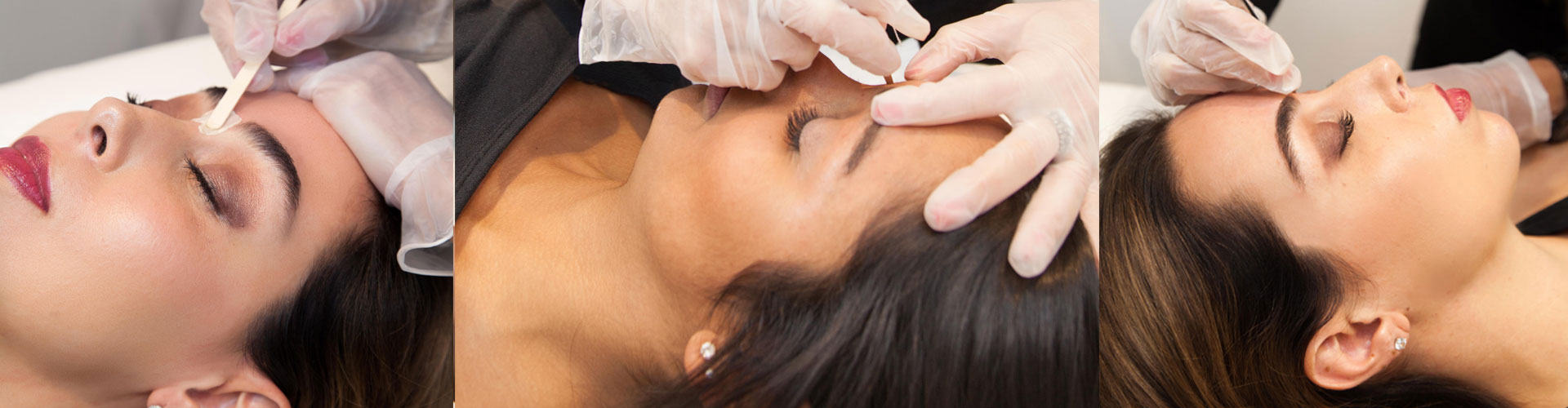  facial hair removal 